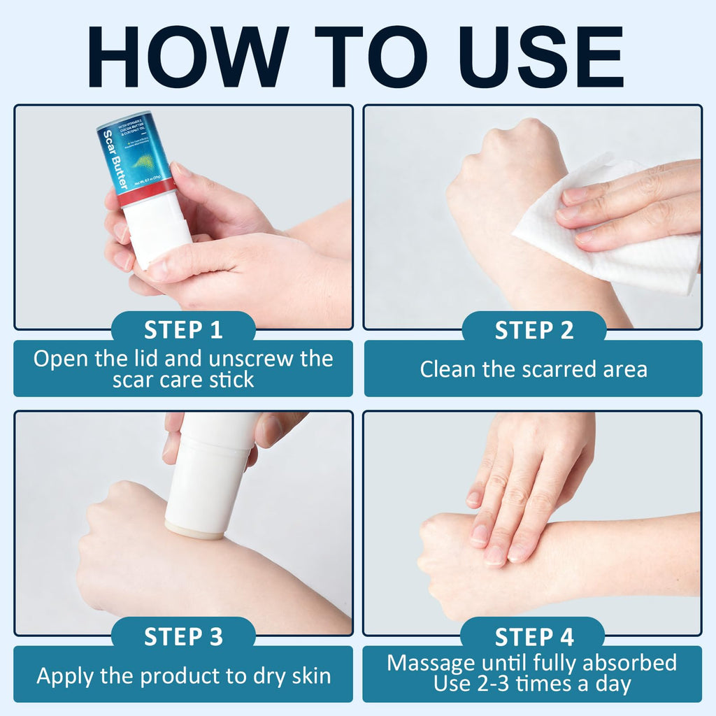 Scar Stick for Scars After Surgery & C-Section, Cocoa Butter Stick with Vitamin E for Scars, 5-in-1 Smoothing Formula to Improves Texture & Discoloration, Non-Greasy (0.7 oz)