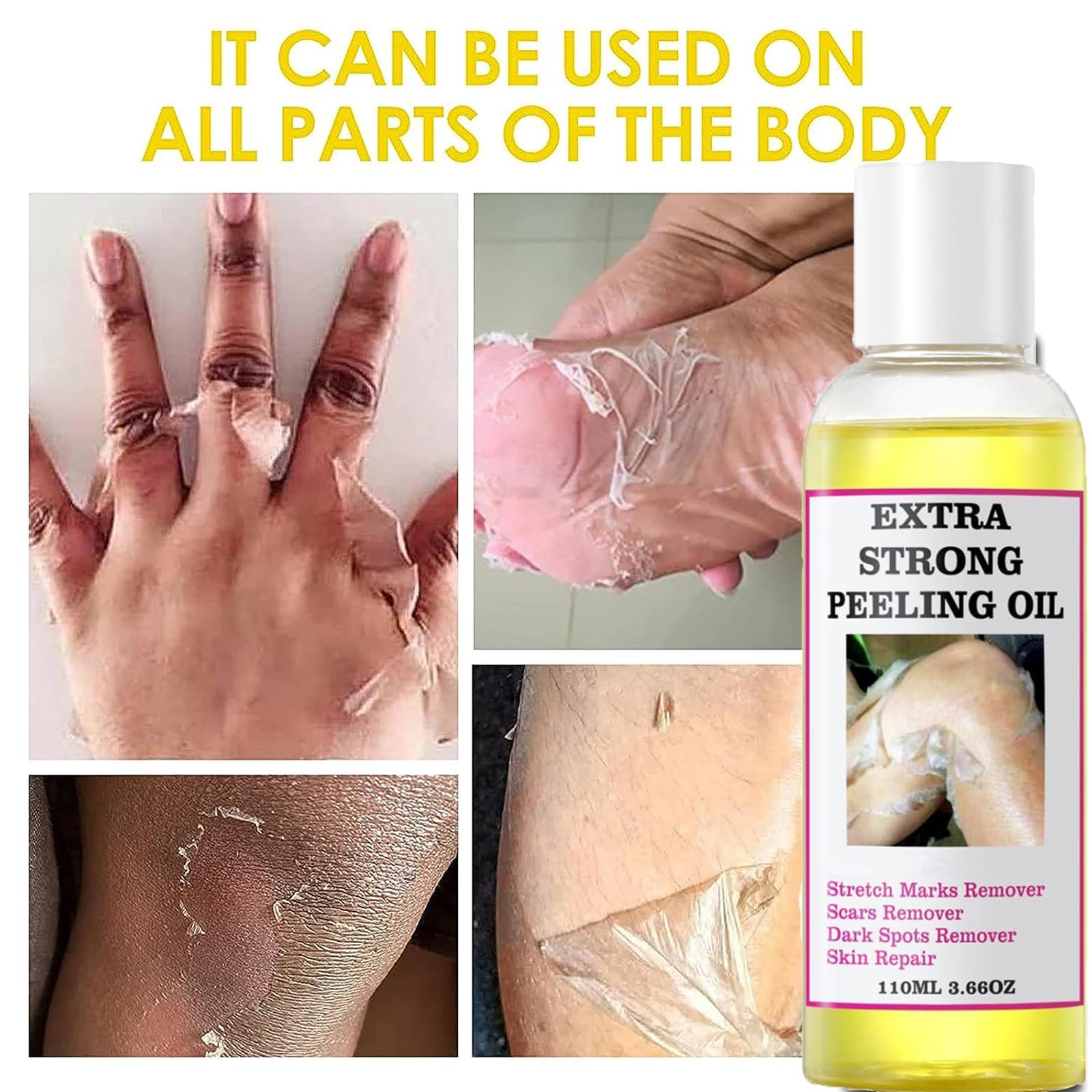 Generic Extra Strong Yellow Peeling Oil for Dark Skin - Exfoliating Solution for Body, Hand, Feet and Face - All Skin Types (110ML/3.88 Fl Oz)