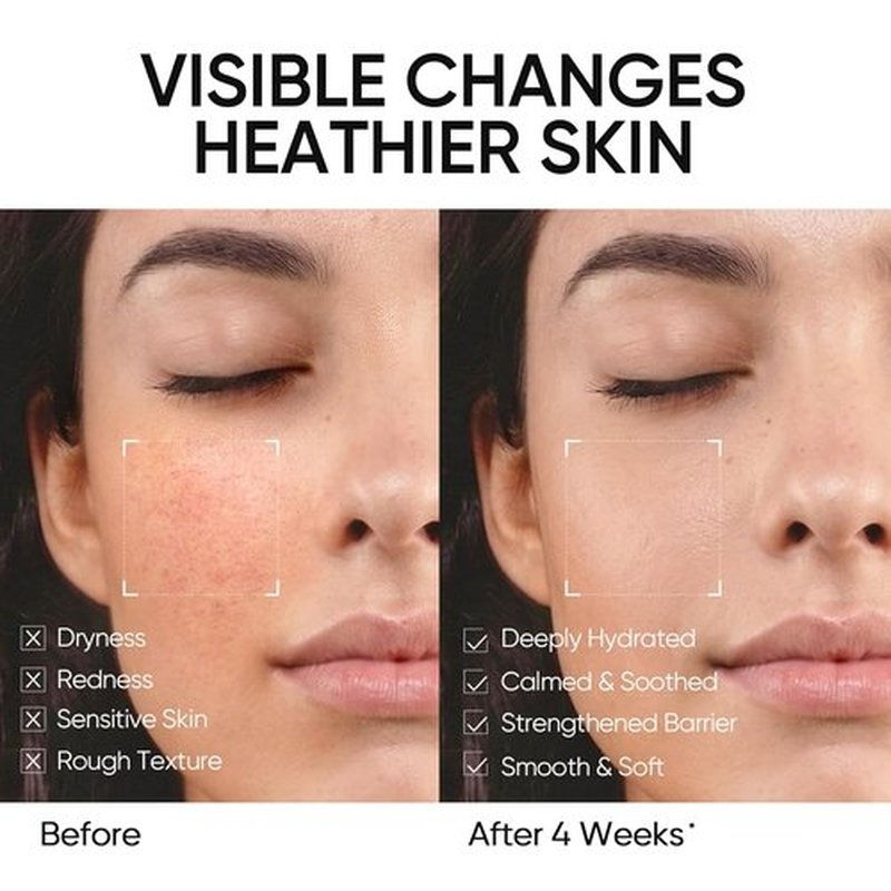 Skintific Face Moisturizer - 5X Ceramides & Hyaluronic Acid for Sensitive/Oily Skin | 30g/1 fl.oz