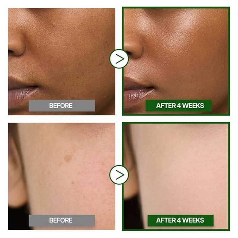 GOODAL Green Tangerine Vitamin C Cream [Advanced Ver.] – Vitamin C Cream with 5% Niacinamide | Fades Dark Spots, Boosts Radiance & Hydrates | Korean Skincare 1.69oz / 50ml