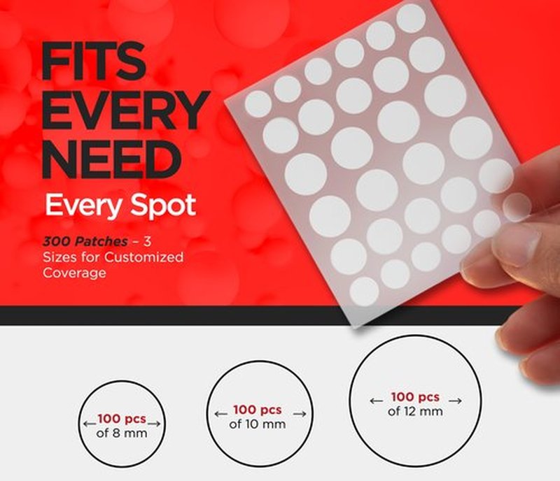 AcneEase Clear Pimple Patches with Ultra-Thin Hydrocolloid – 300 Cosmetic Zit Patches in 3 Sizes – Face Pimple Stickers for Daily Use