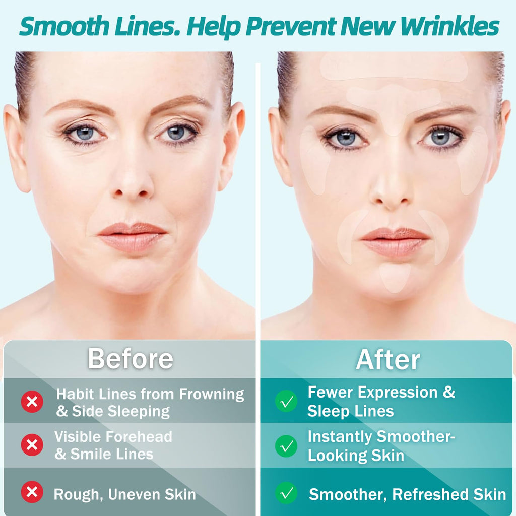 Face Wrinkle Patches Overnight, 208Pcs Wrinkle Tape for Face & Forehead, Anti-Wrinkle Facial Patches for Sleep, Face Tape for Wrinkles, Forehead & Smile Lines Patches, Comfortable Stay-On Design