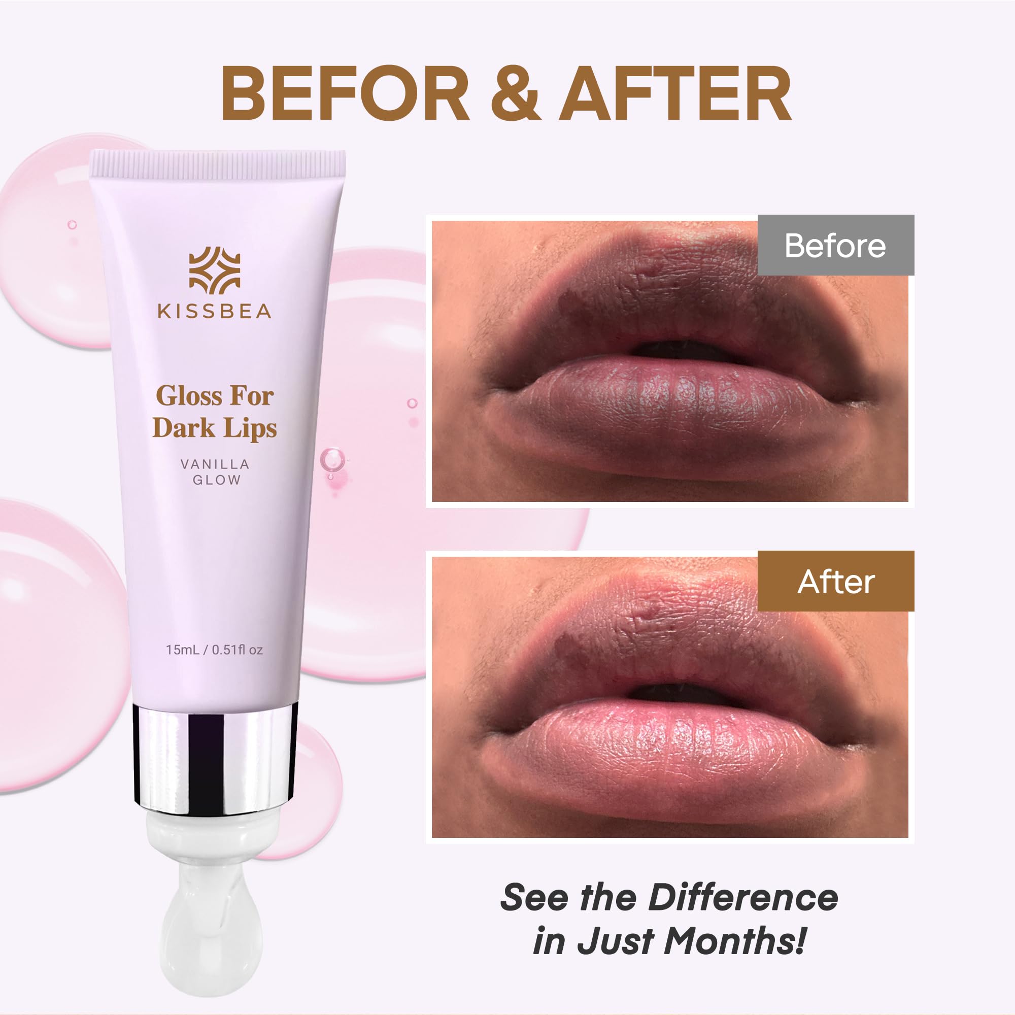 KissBea Lip Lightening for Dark Lips: for Smokers, Dry or Uneven-Toned Lips – Restores Natural Look & Moisture with VC, Lemon Peel & Licorice – Refreshing Vanilla Scent – 15 mL