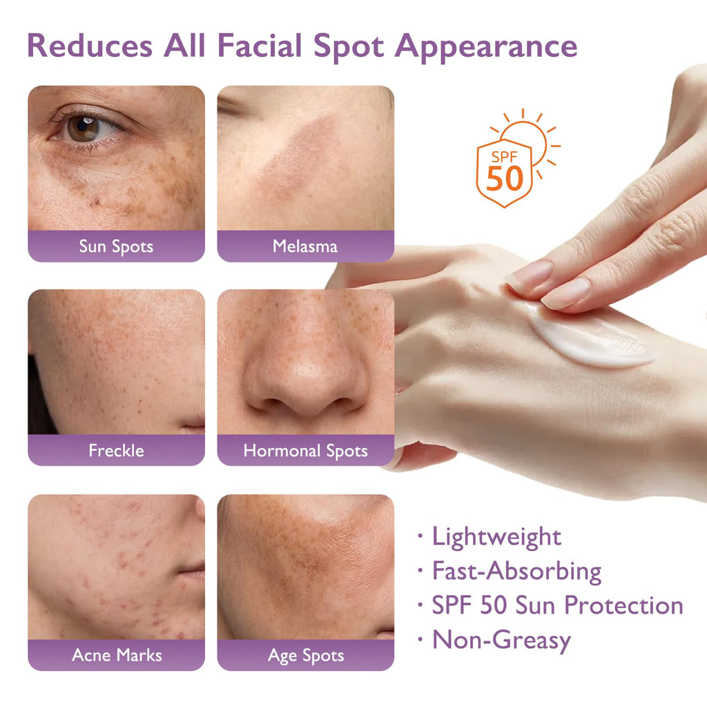 Dark Spot Corrector Serum with Retinol, Niacinamide & Alpha Arbutin, Brightening Face Serum for Uneven Tone, Post Acne Marks & Dull Skin, Hydrating Glow Formula with Hyaluronic Acid
