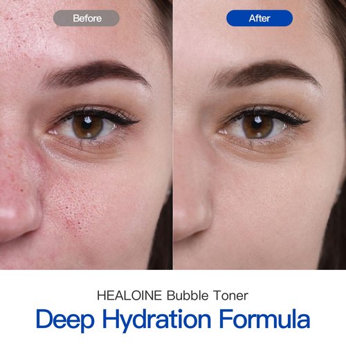Healoine Bubble Toner Deep Moisturizing, Hydrating and Refreshing Cloud Glow Toner for Face Nature Vegan Korean Skin Care 180ml/6.1 fl.oz.