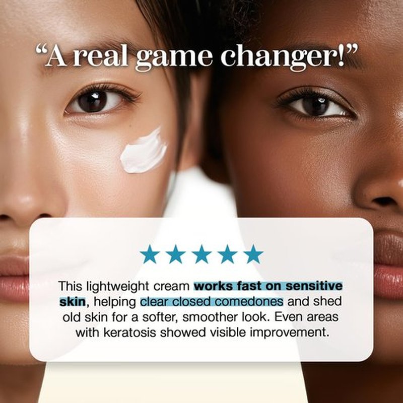 it:fu Soonyuul Cream for Closed Comedones & Acne Care | Barrier Repair Moisturizer with Niacinamide & Coix Seed (1.69 fl oz)