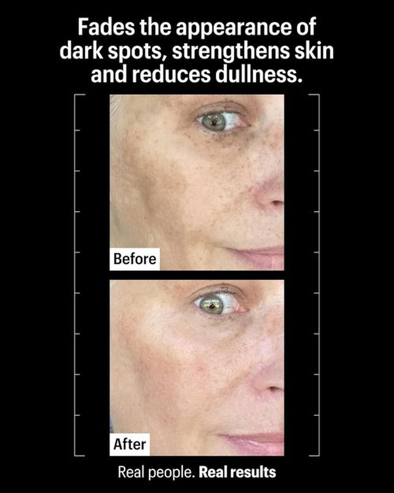 Allies of Skin Advanced Brightening Serum - Lightweight Daily Formula with 3% Tranexamic Acid | 1.6 fl oz