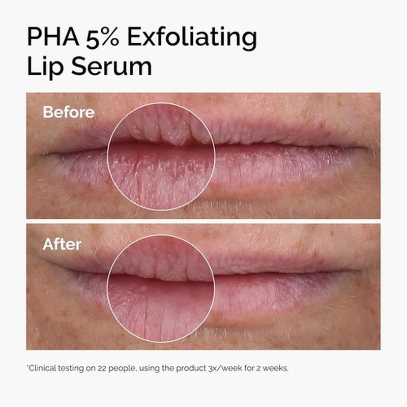 The Ordinary PHA 5% Exfoliating Lip Serum - Hydrating Overnight Treatment | 0.5 Fl Oz