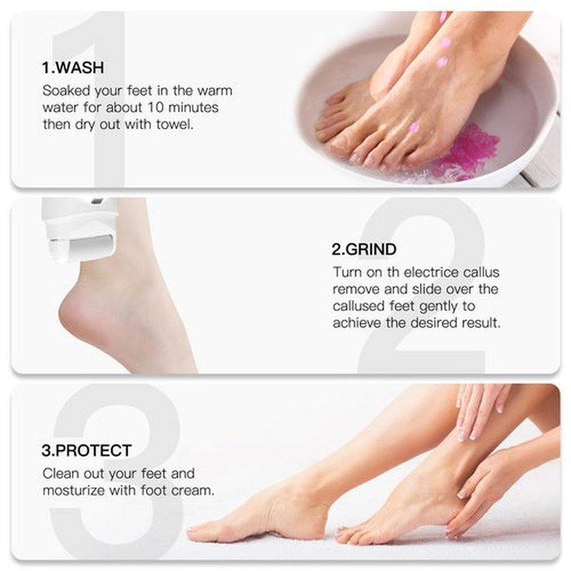 Electric Feet Callus Removers Rechargeable,Portable Electronic Foot File Pedicure Tools, Electric Callus Remover Kit,Professional Pedi Feet Care Perfect for Dead,Hard Cracked Dry Skin Ideal Gift