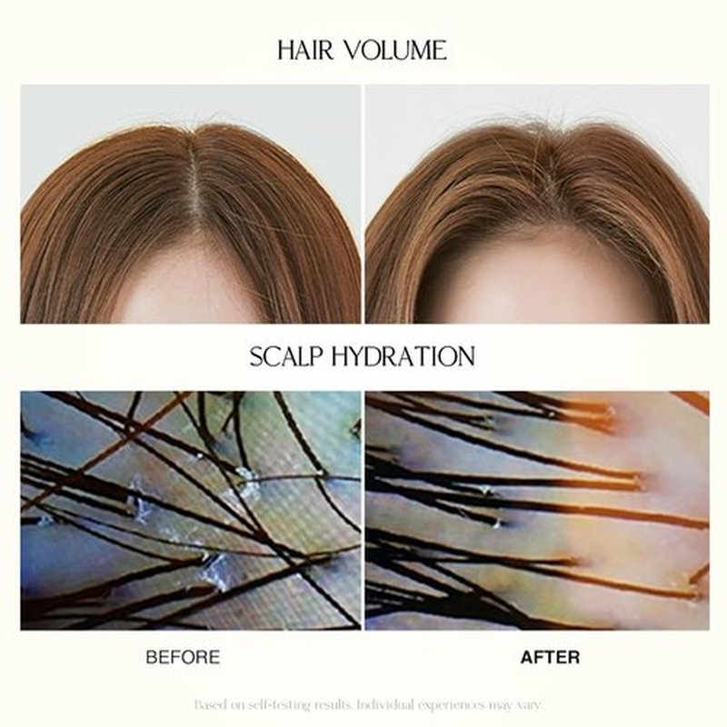Regine Switzerland Mild Moisture Shampoo - Hydrating & Nourishing for Normal to Dry Scalp | 16.9 fl oz