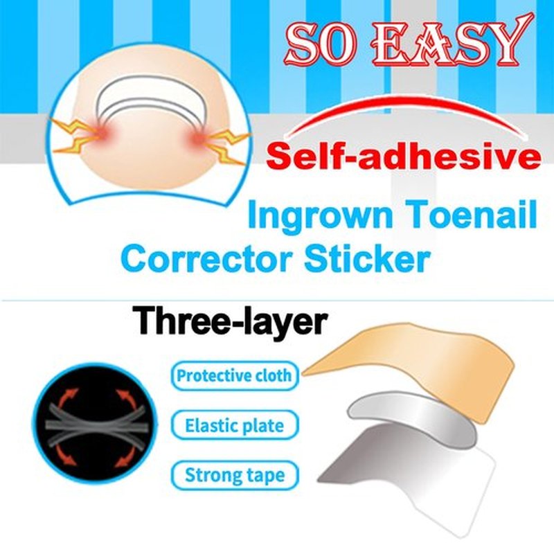 CHEMAILON Professional Ingrown Toenail Correction Kit - Stainless Steel Ingrown Toenail Clippers, Correction Patches, Lifter & Tools for Ingrown Toenail Treatment, Home Pedicure Solution