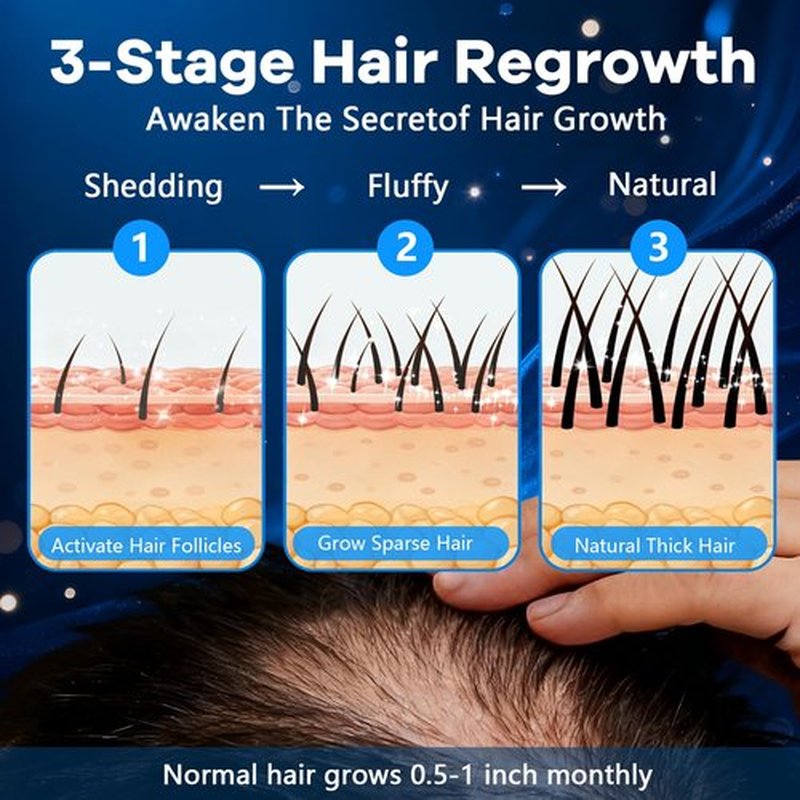 5% Topical Minoxidil Foam, Aerosol Minoxidil for Men, Infused with Biotin, Hair Growth Treatment, Supports Thicker and Fuller Hair & Beard Unscented (Minoxidil Foam, 8.44oz, 4 Months Supply)