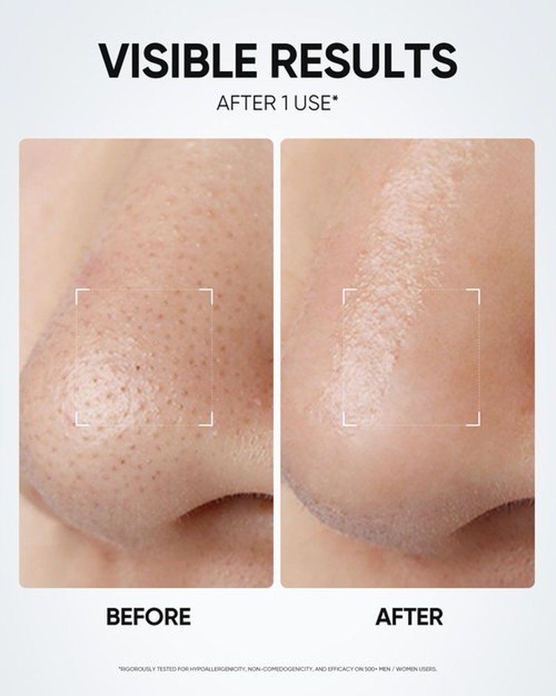 SKINTIFIC Deep Pore Cleansing Blackhead Remover Face Mask Stick, Mud Mask with Natural Alaska Volcano Clay, Gentle Exfoliating, Smoothing Skin, Non-Drying, Skincare Facial Mask