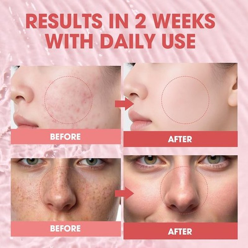 PDRN Pink Glow Serum - Hydrating Korean Peptide & Niacinamide Formula for Firm, Bright Skin | 1.01 fl. Oz