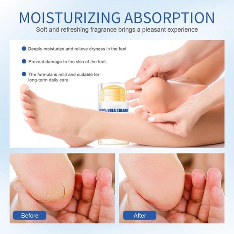 60% Urea Plus 2% Salicylic Acid Foot Balm Stick, 2025 Upgraded Urea Cream Moisturising and Relieves Cracking & Dryness, Natural Formula Cracked Heel Stick Repairs Dry Cracked for Feet and Hand (2PC)