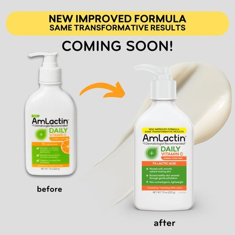 AmLactin Daily Vitamin C Lotion – Brightening Body Lotion for Dry Skin - No-Scrub Exfoliator and Moisturizer with 7% Lactic Acid AHA and Vitamin C, 7.9 oz (Packaging May Vary)