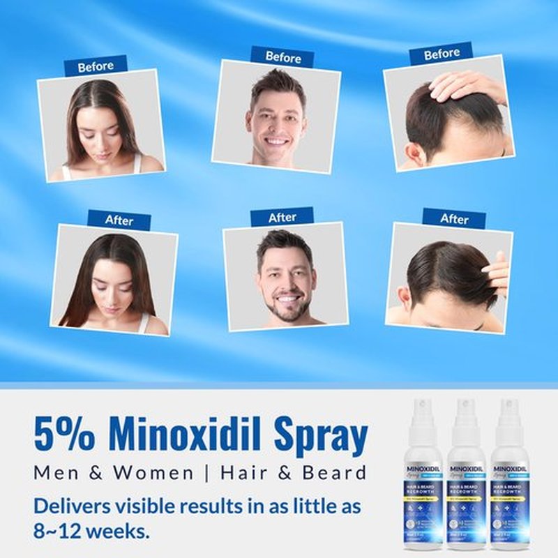 5% Minoxidil Spray 3PCS, Minoxidil for Men Hair and Beard, Minoxidil for Women Hair Growth, Minoxidil for Men Hair Growth.