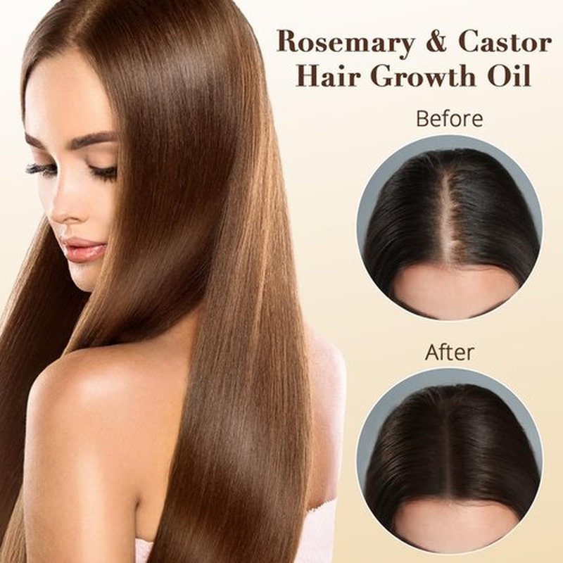 ChLNDalin Organic Rosemary & Castor Hair Growth Oil + Scalp Massager Set, Hair & Scalp Care Oil, Lightweight Moisturizing Formula for for Dry, Damaged & Split End 1pc