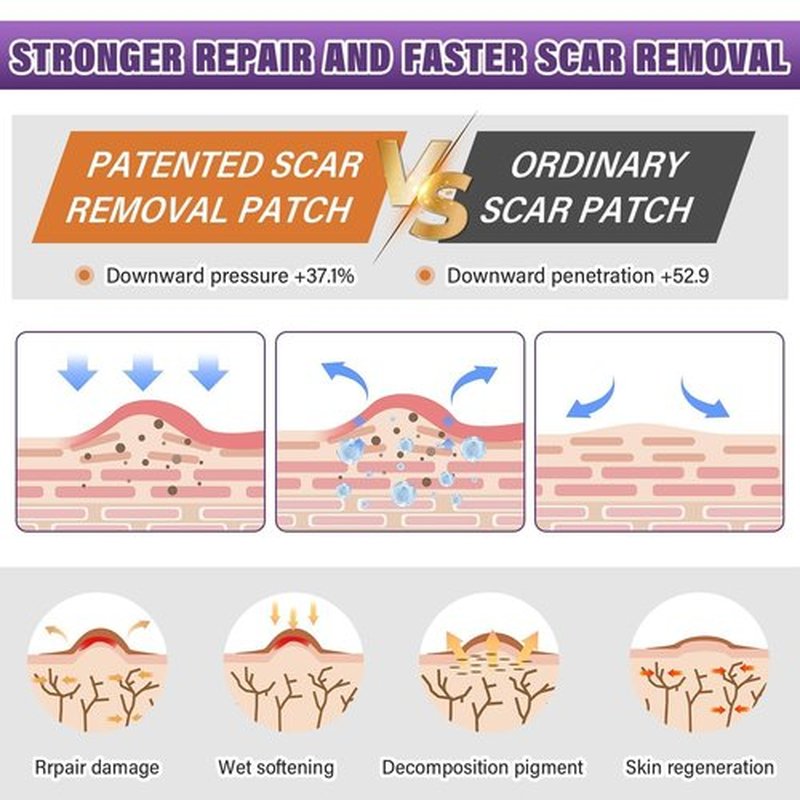 Silicone Scar Sheets,Silicone Scar Tape,Silicone Scar Removal Strips for Surgical,C-Section,Tummy Tuck,Keloid Scars (1.6"X 157" Roll-4M) Keloid Bump Removal