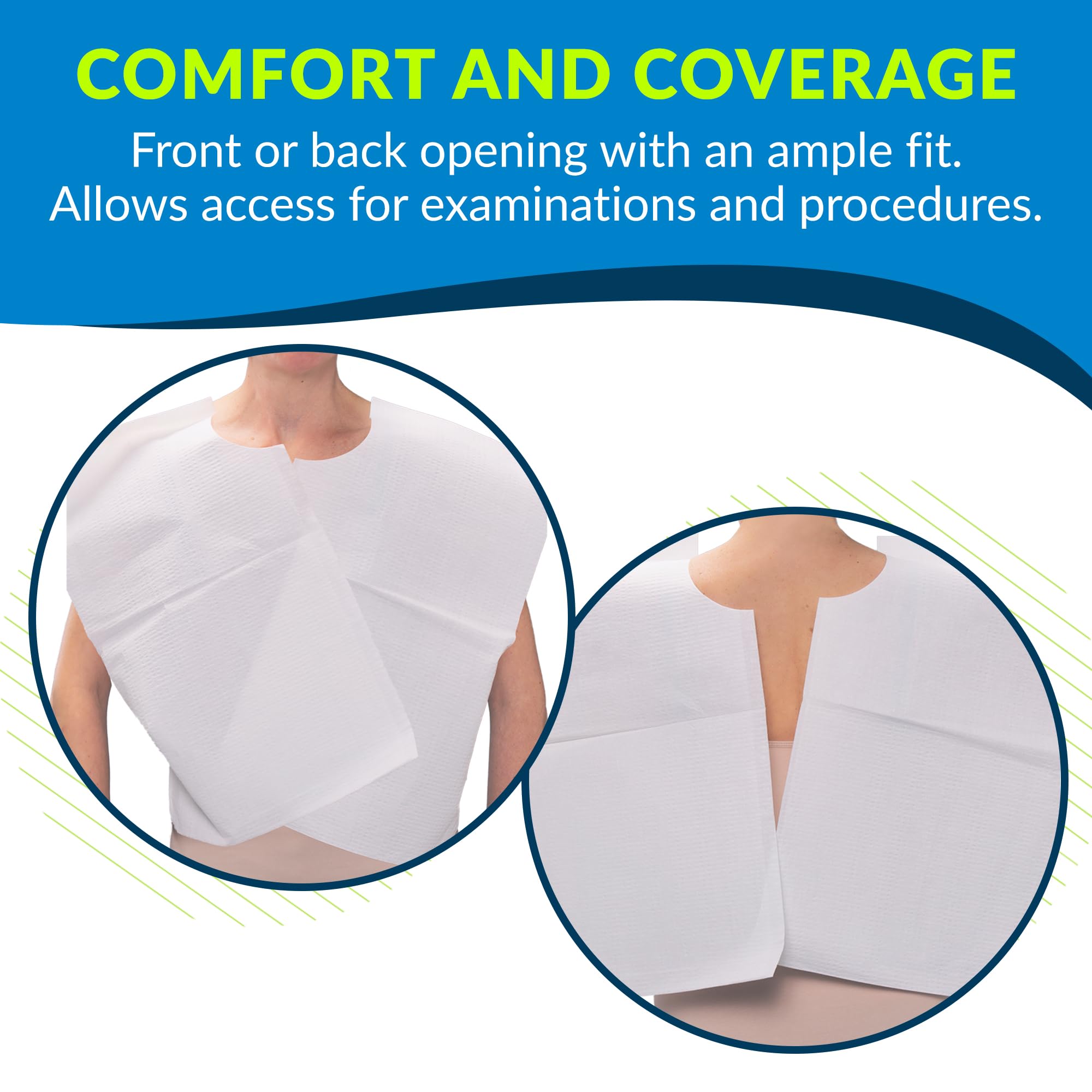 TIDI 911 Avalon Capes, White (Pack of 100) ― Tissue/Poly/Tissue ― Short-Sleeve, Open-Back Exam Capes ― Short, Disposable Medical Gowns ― Standard Size (30” x 21”) ― Latex-Free Medical Supplies