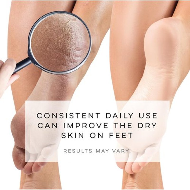 LE EMILIE 5 Toe Moisturizing Gel Socks | Perfect for Healing Dry Cracked Heels and Feet | Infused with Aromatherapy Blend of Lavender and Jojoba Oil | 1 Pair (Green Heel)