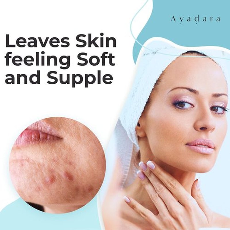 Ayadara Acne Facial Moisturizer - Advanced Oil Control Hydrating Cream for Oily Skin | 2 fl oz