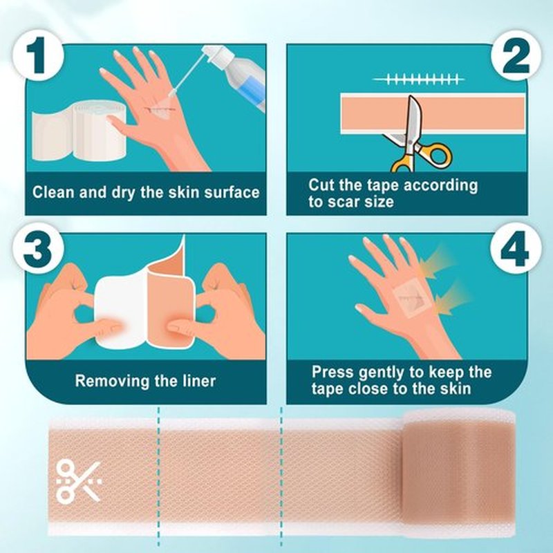 Arme Silicone Scar Tape, 1.6" x 240" Silicone Scar Sheets(2 Rolls-6M), Medical Grade Scar Tape Removal Sheets for Surgical Scars, Reusable Scar Removal Strips for Tummy Tuck C-Section Keloid