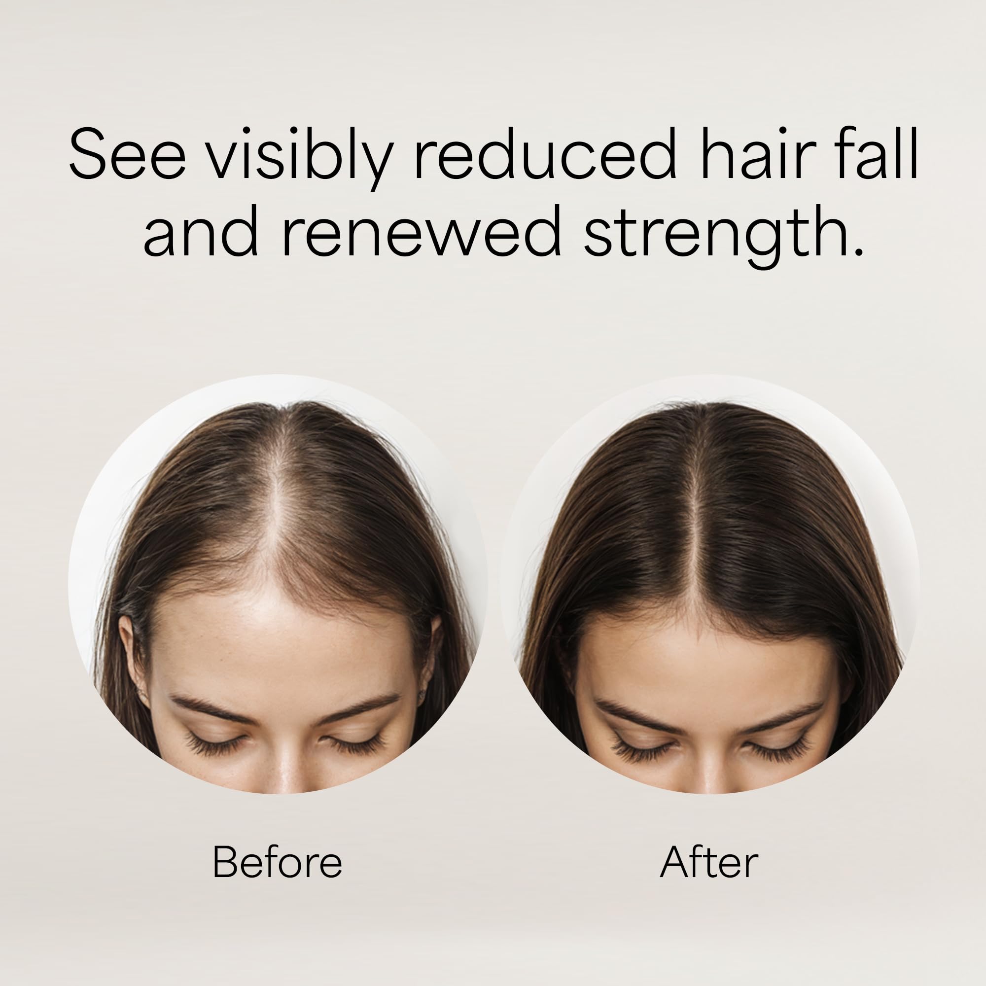 Kismera Line Hair Loss Control Shampoo 16.9oz "Set of 2"