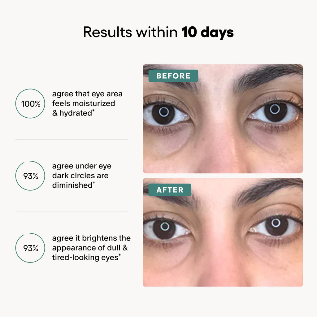 Algenist Triple Algae Eye Renewal Balm - Hydrating Vegan Eye Cream with Caffeine, Alguronic Acid & Peptides to Help Reduce Dark Circles, Puffiness, Fine Lines & Wrinkles - Travel Size (0.5 oz)