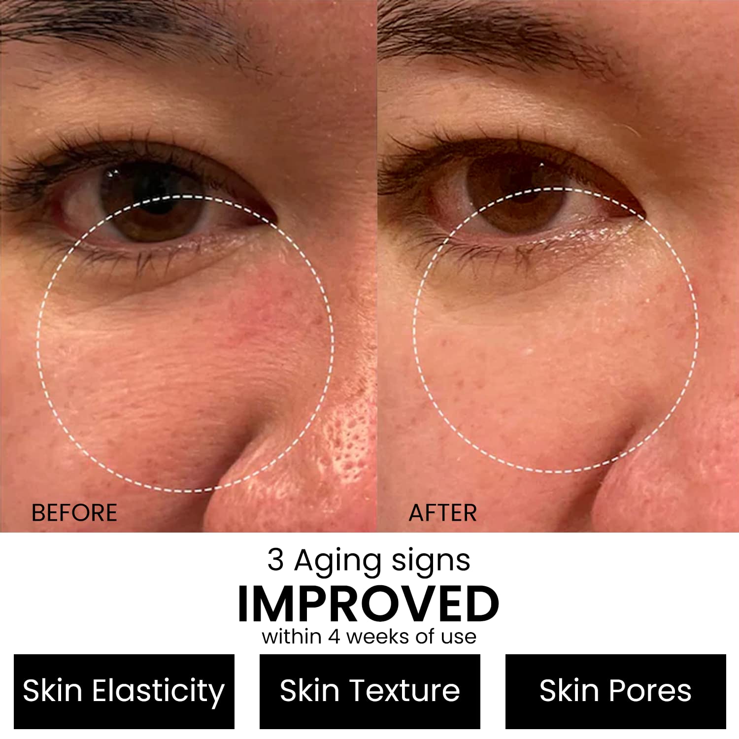 Kleem Retinol Serum 2.5% for Face Anti-Aging Serum with Hyaluronic Acid to Minimize Wrinkles. Improves Sun Damaged Skin and Fades Dark Spots - Vitamin A Serum - Dermatologist Tested (1oz)