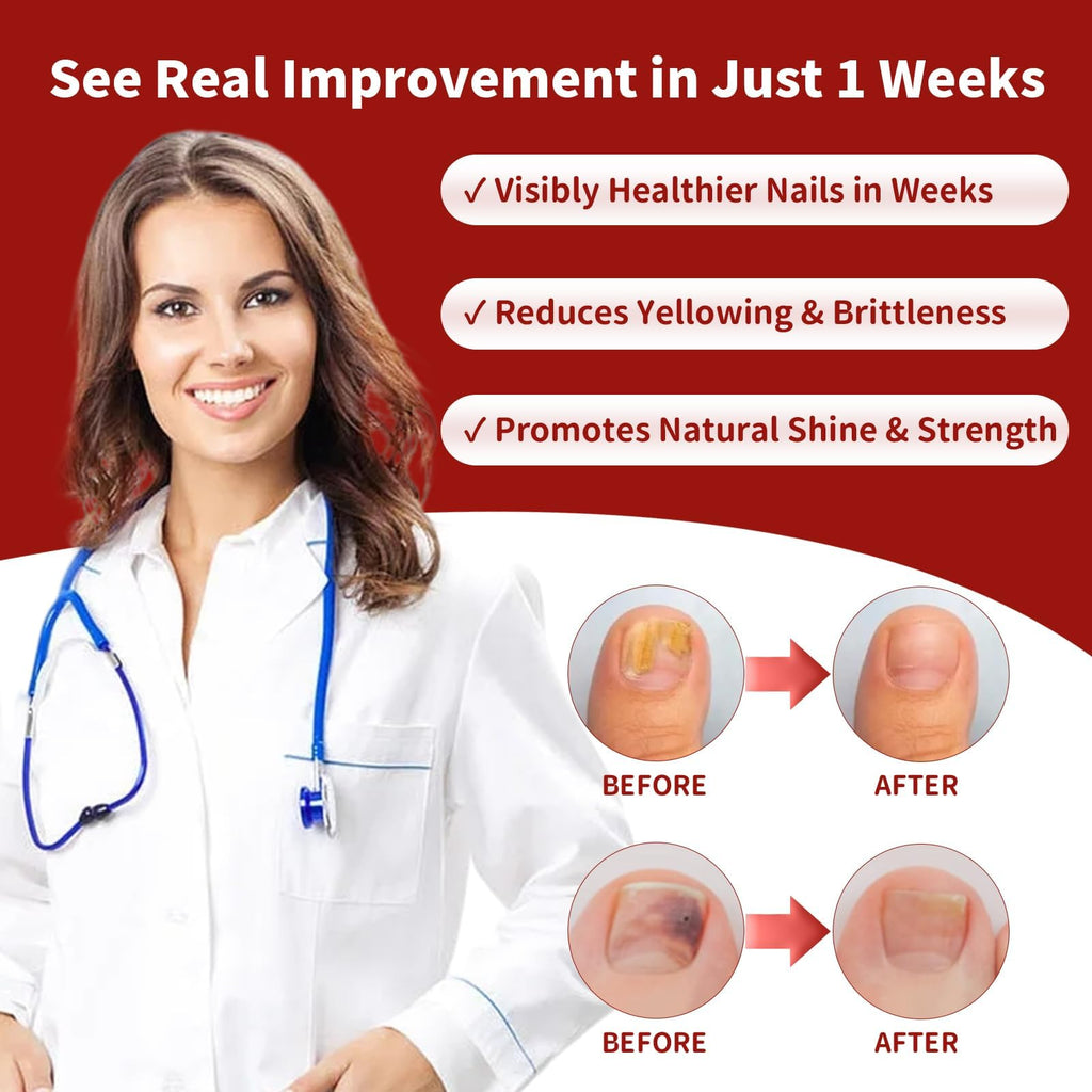 Toenail Fungus Treatment Extra Strength, Nail Fungus Treatment with Undecylenic Acid for Toenail & Fingernails, Antifungal Nail Repair for Athletes Foot, Ingrown, Thick, Broken, Damaged Nail, 30ml