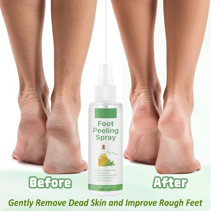 AOPEIBOTO Foot Peeling Spray, Tea Tree Foot Exfoliator Spray, Vegan Botanicals, Moisturizing & Smooth Feet Skin, Gently Exfoliates Away Rough, Dry Skin, 4.06fl.oz/120ml