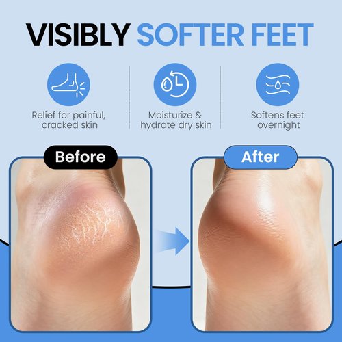 Silicone Moisturizing Socks for Women Men Large- 2Pairs Foot Moisturizer Socks for Dry Cracked Feet- Black Aloe Spa Moisture Hydrating Foot Care Socks (L Up to Size 12)