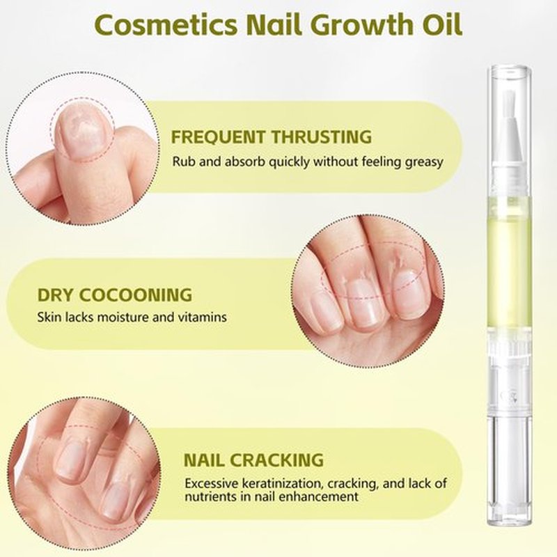 Nailz Nail 𝐆𝐫𝐨𝐰𝐭𝐡 Pen,Radiant Nail Growth GIL,Radiant Nail Growth Oil Pen,Cuticle Oil for Nails,Nail Strengthener, for Moisturize Strengthen Nail Care,Finger Edge Manicure Nourishing Pen(4PCS)