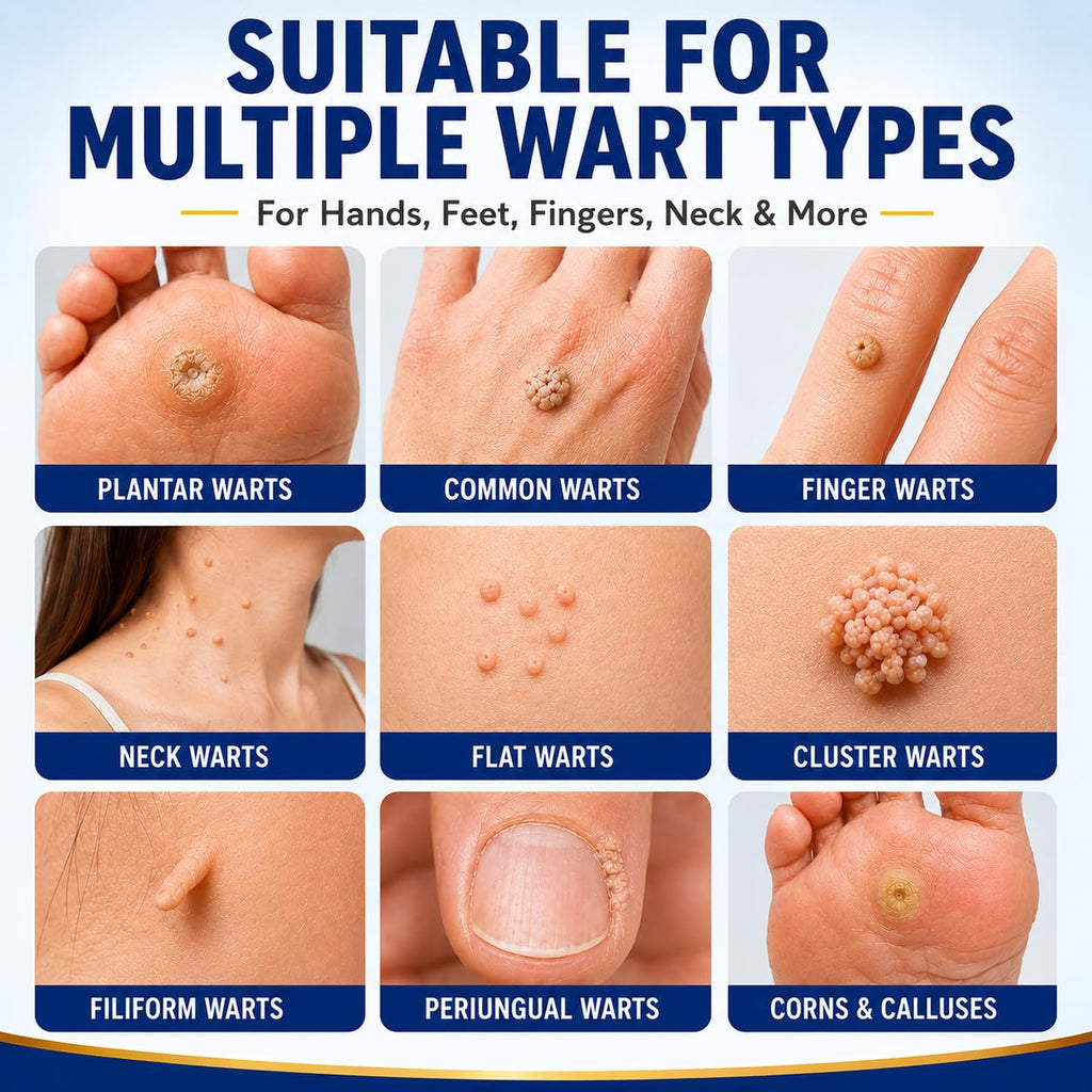 DVO Wart Remover, 20% Salicylic Acid Wart Remover Liquid – Fast Acting Wart Treatment with Precision Brush Applicator, Wart Remover for Hands, Feet & Body 15ml