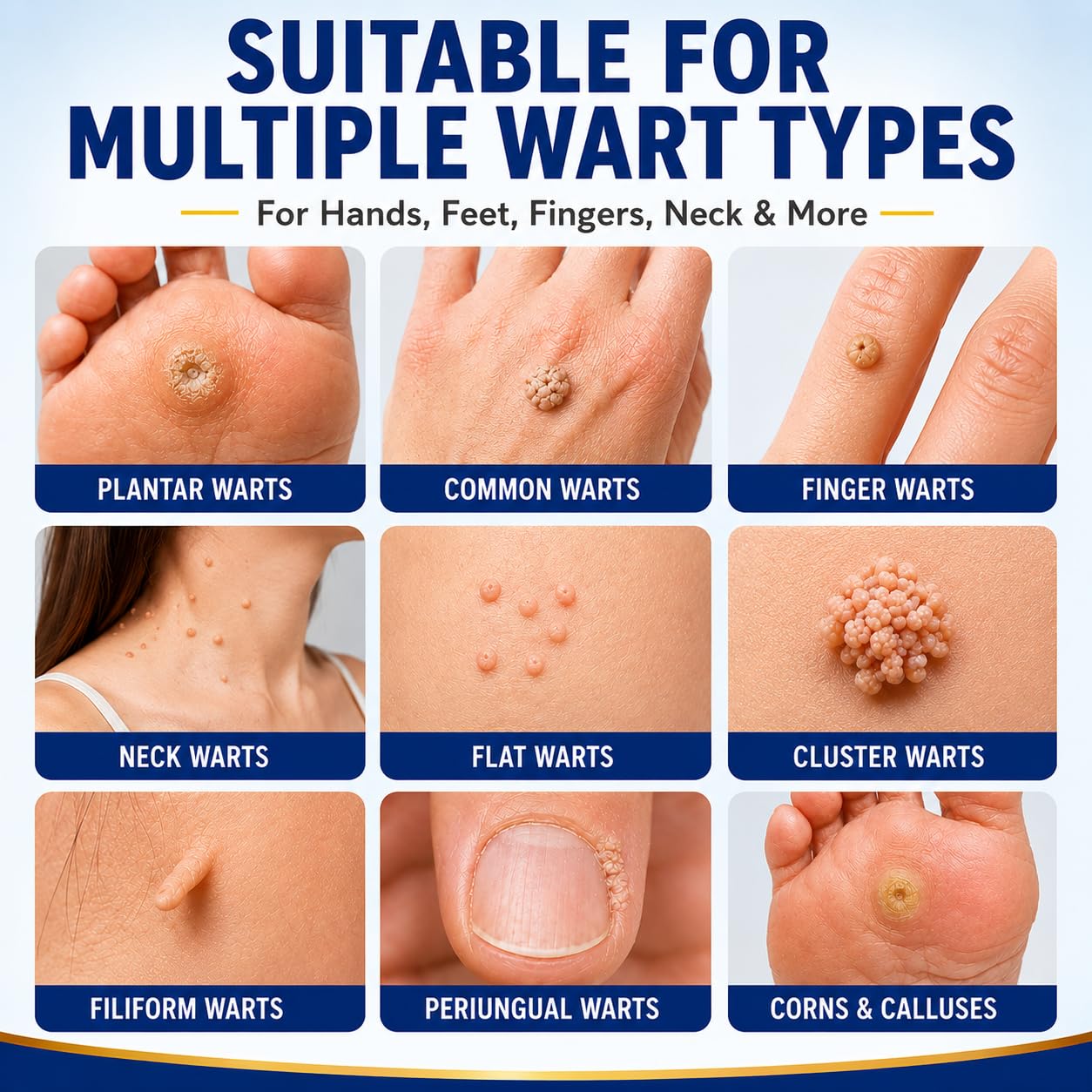 DVO Wart Remover, 20% Salicylic Acid Wart Remover Liquid – Fast Acting Wart Treatment with Precision Brush Applicator, Wart Remover for Hands, Feet & Body 15ml