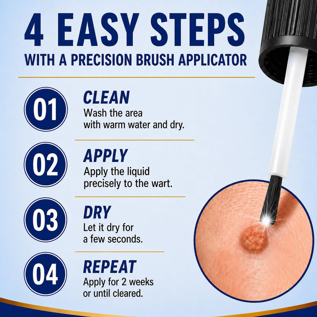 DVO Wart Remover, 20% Salicylic Acid Wart Remover Liquid – Fast Acting Wart Treatment with Precision Brush Applicator, Wart Remover for Hands, Feet & Body 15ml