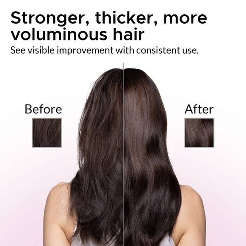 Minoxidil Shampoo for Women – Growth Essence Premium 2% Hair Regrowth Shampoo with Biotin, Caffeine & DHT Blockers – Strengthening Formula with Keratin, Castor Oil, Green Tea & Rosemary – 12.17 fl oz