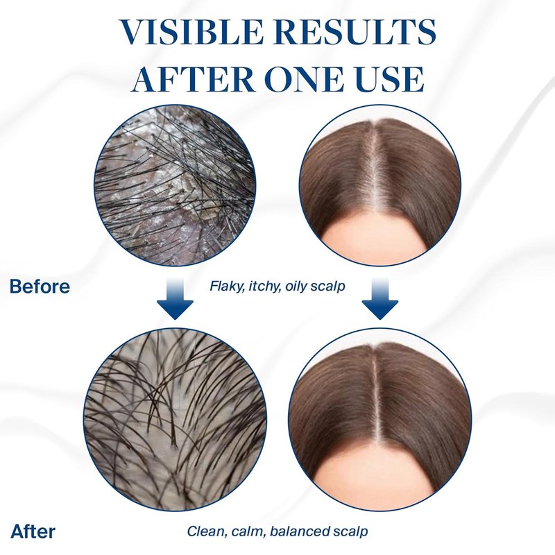 Voir Haircare Scalp Serum - Hydrating & Soothing Formula for Dry, Itchy Scalp | 30ml with Canadian Glacial Oceanic Clay