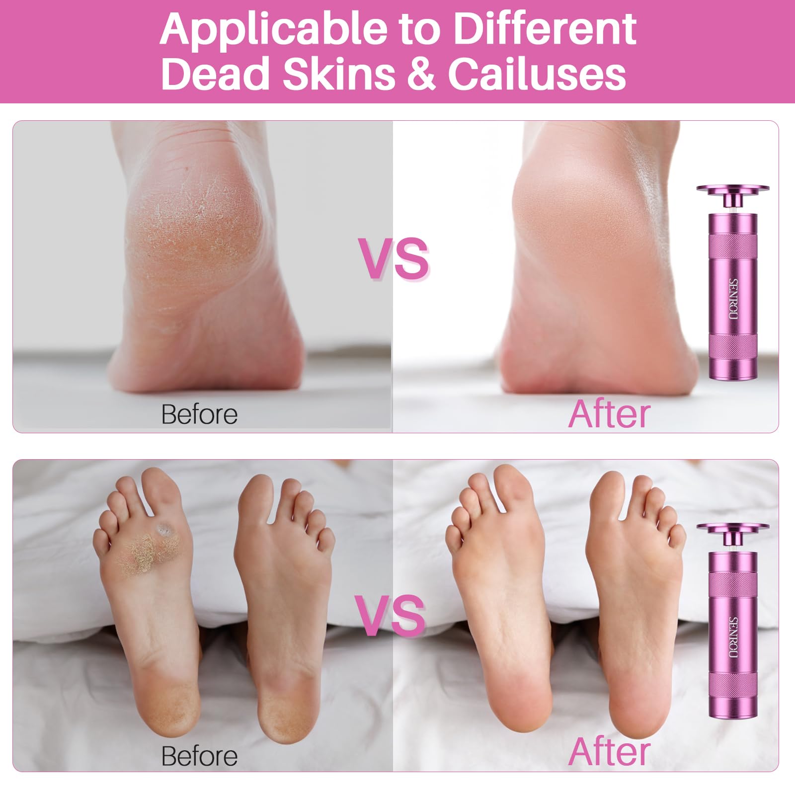 Electric Foot Callus Remover, 2-in-1 Electric Foot Filer/Nail Filer, Callus Remover for Feet with 60Pcs+12Pcs Sandpaper Discs，Holiday Gift Foot Repair Tool, Pink