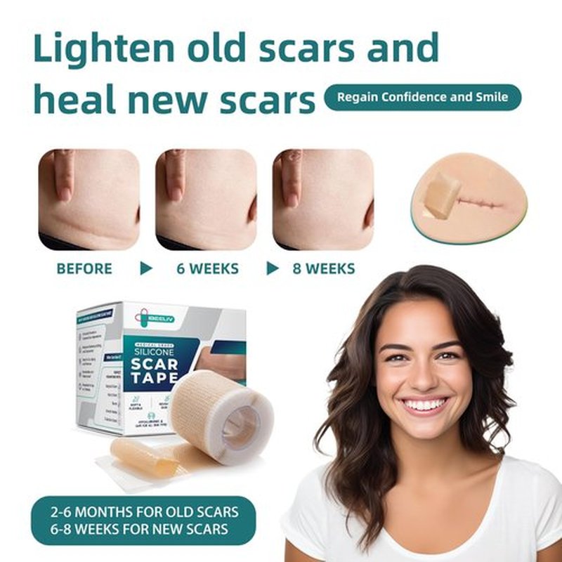 Silicone Scar Gel Sheets: Medical Grade Scar Tape for C Section Surgical Tummy Tuck Keloid Treatment–Scar Removal for Face and Skin
