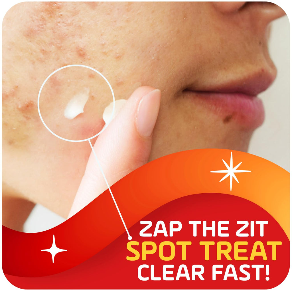 Asepxia 2% Salicylic Acid Acne Spot Treatment Cream | Drying Formula Targets Acne, Clears & Prevents Blemishes, Reduces Redness, Penetrates Pores, Pimple Cream, 1 Oz, 1-Pack