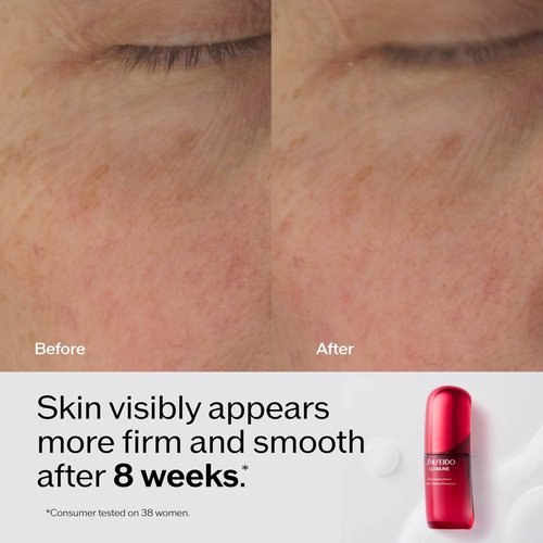 Shiseido Ultimune Power Infusing Serum - Lightweight Anti-Aging Face Serum - Boosts Radiance for All Skin Types