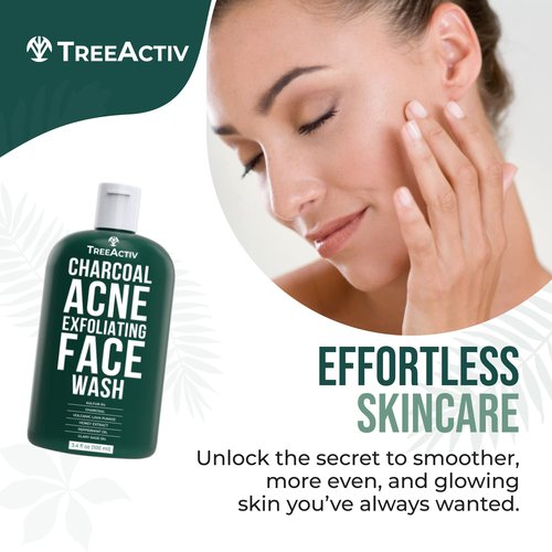 TreeActiv Acne Charcoal Face Wash 3.4 oz, Exfoliating Daily Honey & Sulfur Acne Cleanser Face Soap, Deep Cleansing Moisturizing Face Wash for Women and Men