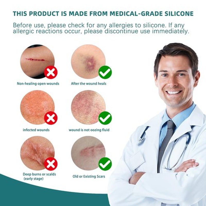 Silicone Scar Gel Sheets: Medical Grade Scar Tape for C Section Surgical Tummy Tuck Keloid Treatment–Scar Removal for Face and Skin