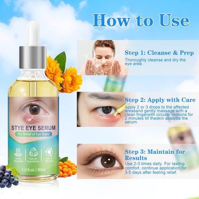 Stye Eye Relief Serum Natural Eyelid Drops for Styes Blepharitis & Chalazion Fast-Acting Relieve Eye Irritation Redness & Swelling Gentle Formula 1.01 Fl oz/30 Ml