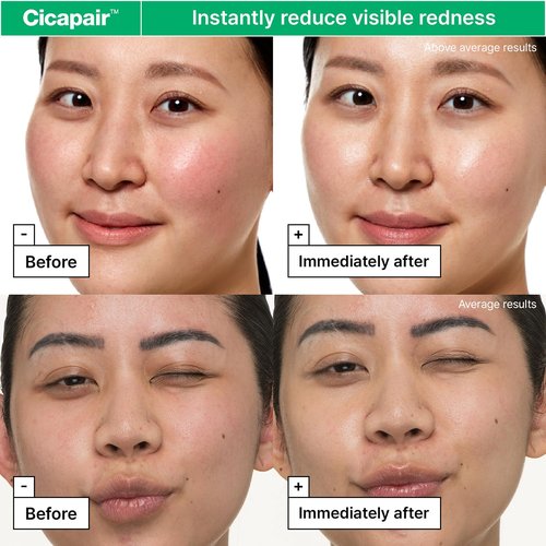 Dr.Jart+ Cicapair Face Moisturizer - Soothing Redness Relief & Barrier Repair with Centella Asiatica | Korean Skin Care