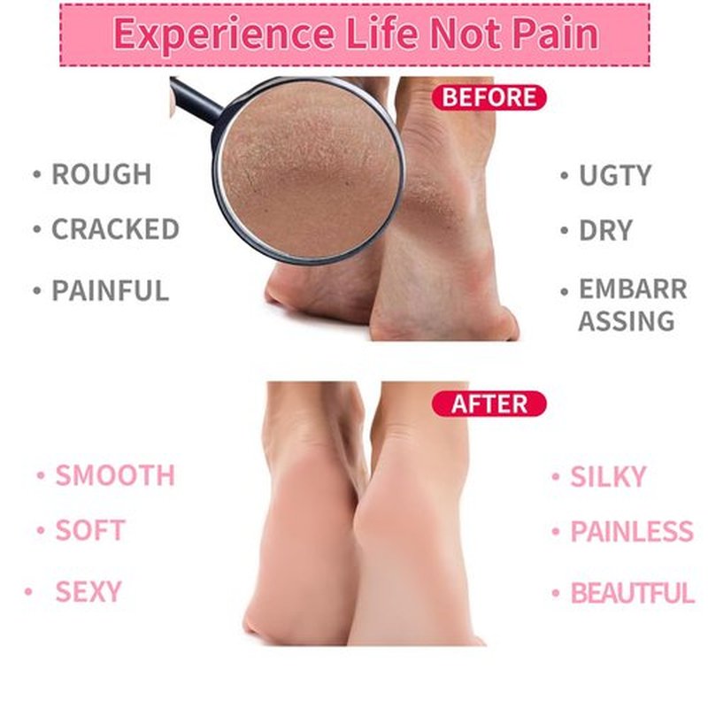 Giloner Foot Moisturizing Socks(Size 5.5-8.5) 2Pairs,Silicone Socks for Women,Gel Socks for Foot Care,Silicone Socks for Repairing and Softening Dry Cracked Feet Women-Self Care Gifts