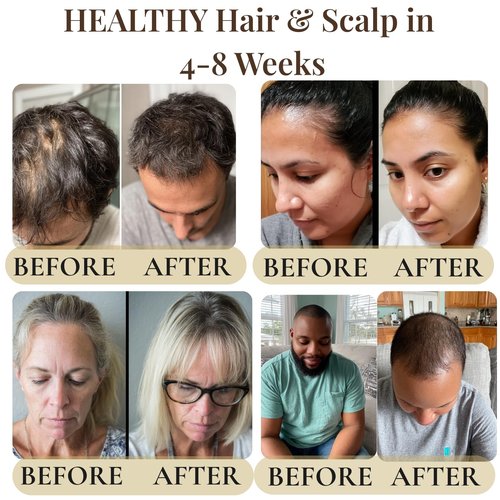 REVATOLOGY Hair Growth Oil for Adults (Made in USA) pre-rinse Formula with 30 Oils and Herbal extracts Reduces Hair Fall, Boosts Regrowth & Strengthens Roots | Cruelty & Chemical Free