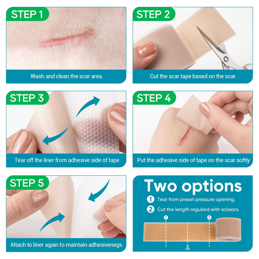VPRIME SAFETYFY Silicone Scar Tape, Silicone Scar Sheets for Surgical Scars (1.6"x 80" Roll-2M), Medical Ggrade Scar Tape for Scars, Keloid, Acne Scars, Burn, C-Section, Stretch Marks Scars Away